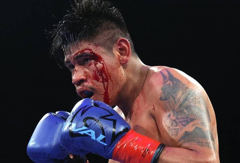 Эмануэль Наваррете / Top Rank