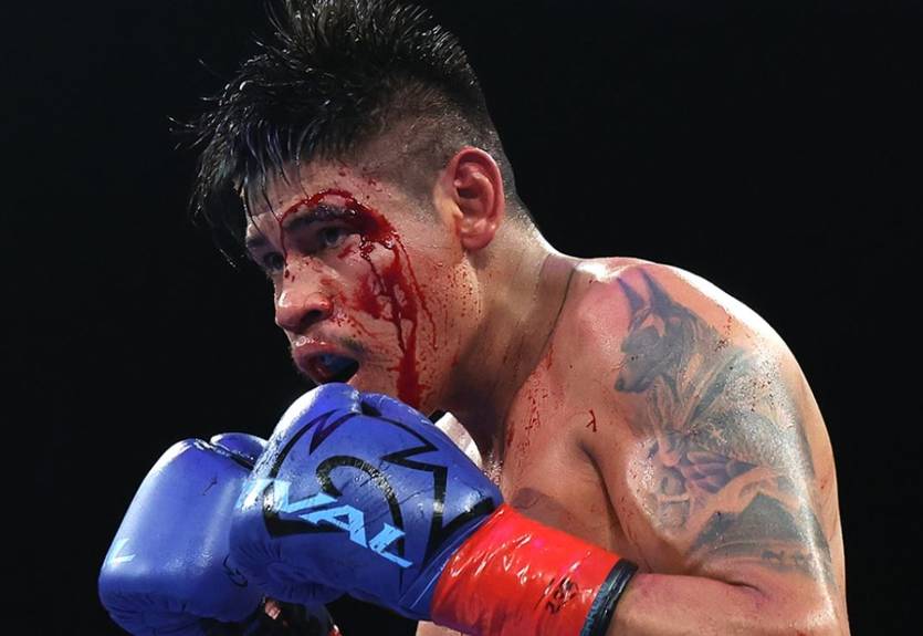 "Был удар головой": Наваррете объяснил скандальную остановку боя с Суаресом