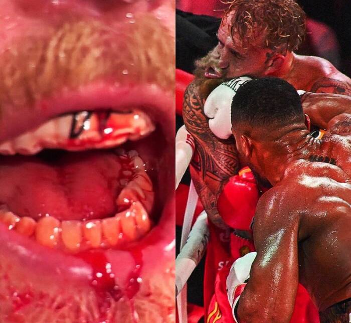 �������: @clippedszn