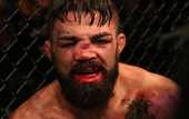 Боец UFC получил жуткую травму носа после удара коленом Боец UFC получил жуткую травму носа после удара коленом