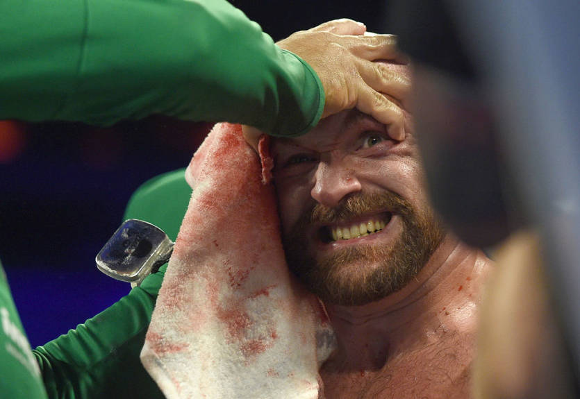 Фьюри в бою против Уаллина получил жесткое рассечение