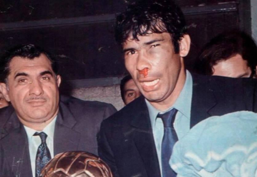 Кровь, грязь и Аргентина: самый жестокий матч в истории футбола