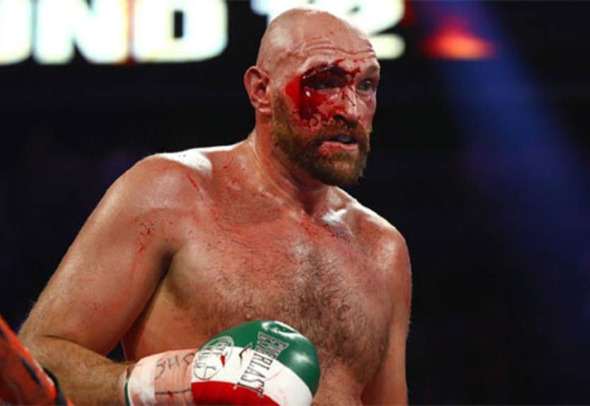 Фьюри будет беречь себя в спаррингах перед реваншем с Уайлдером