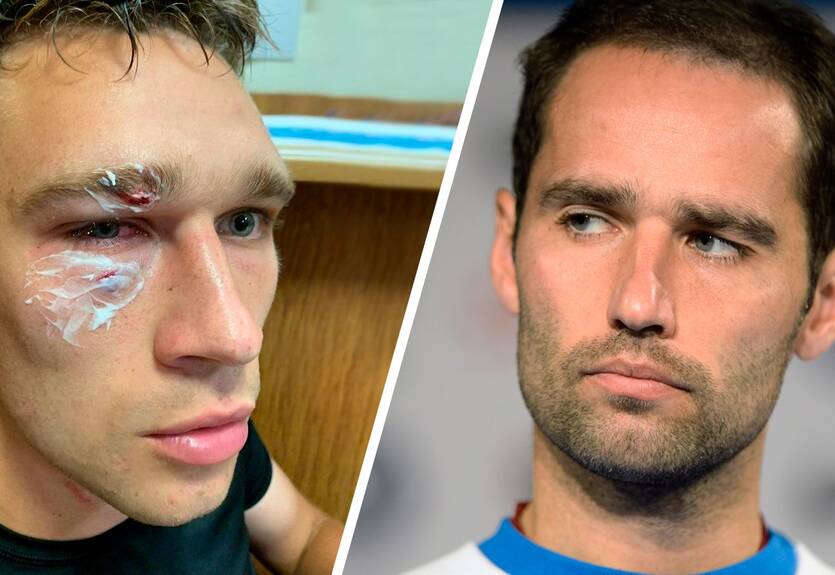 Широков жестко нокаутировал судью и добил его ногами во время матча