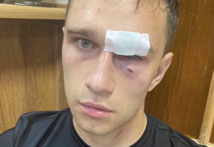 Судья, которого избил Широков: Если бы я не закрывал лицо руками, удар оказался бы фатальным