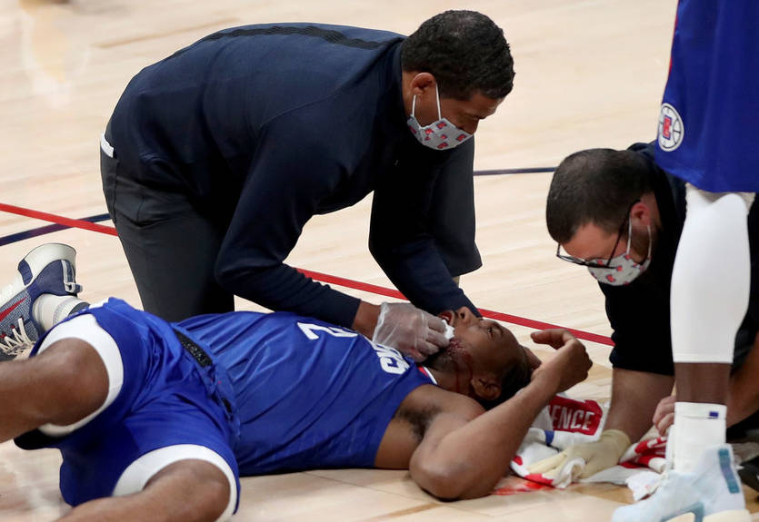 Кавай Леонард получил по голове от одноклубника и залил кровью паркет Кавай Леонард получил по голове от одноклубника и залил кровью паркет