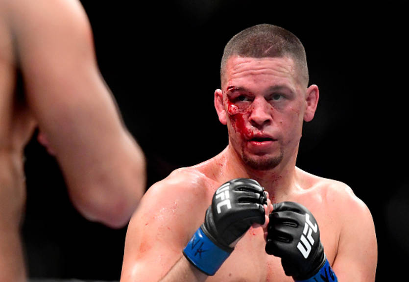 Нэйт Диас возвращается: американец должен провести бой в легком весе