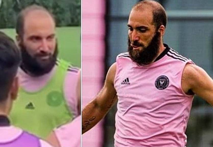 Игуаин шокировал новым имиджем