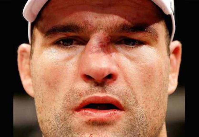 Маурисио Руа потребуется операция