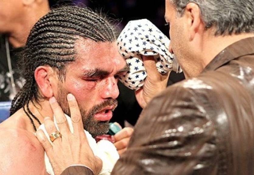 Ангуло: "Уважаю Канело за согласие на бой со мной"