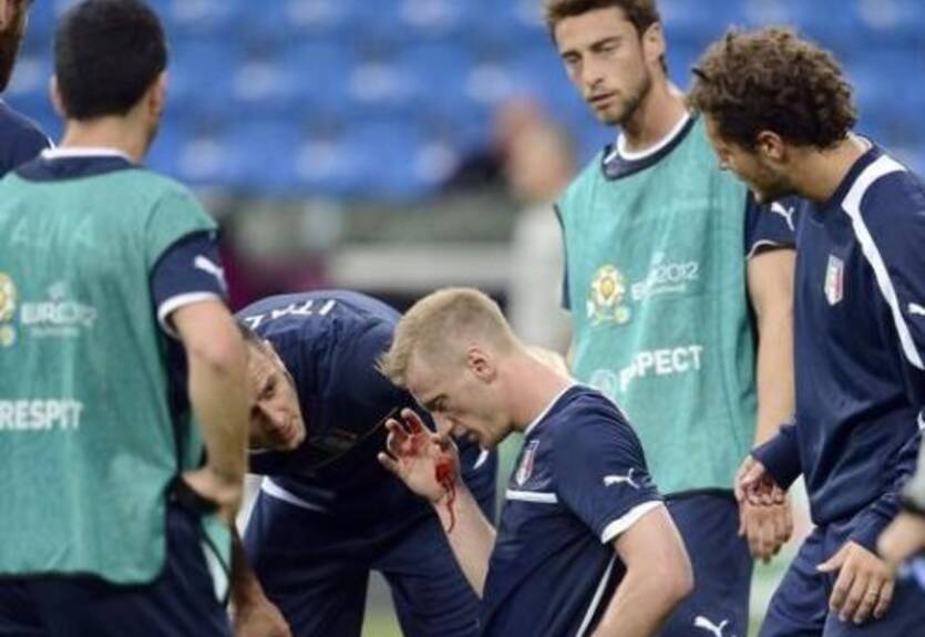 Абате будут зашивать лицо