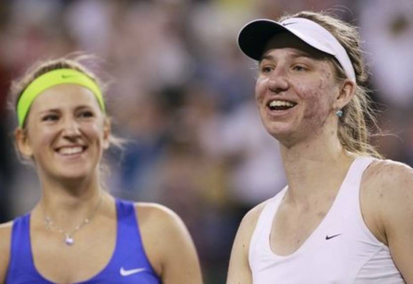 Бартель: "Азаренко заслужила победу"