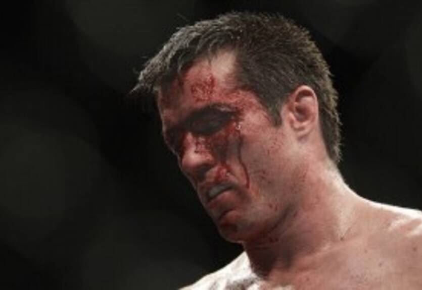 Президент UFC: "Мы не собираемся идти на компромисс в деле Соннена"