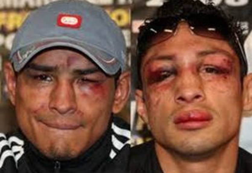 Васкес хочет вернуться на ринг