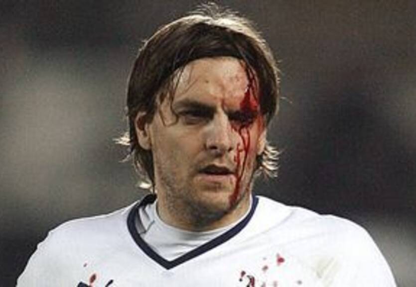 Реднапп не верит в исцеление Вудгейта