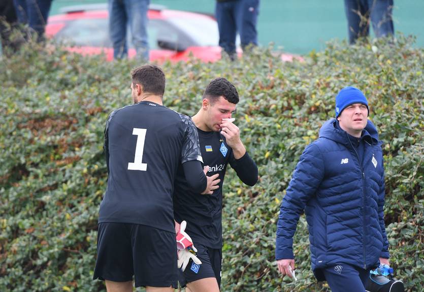 Нещерет пропустит второй тренировочный сбор Динамо из-за перелома носа