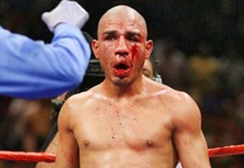 Стюард беспокоится за рубцовую кожу Котто