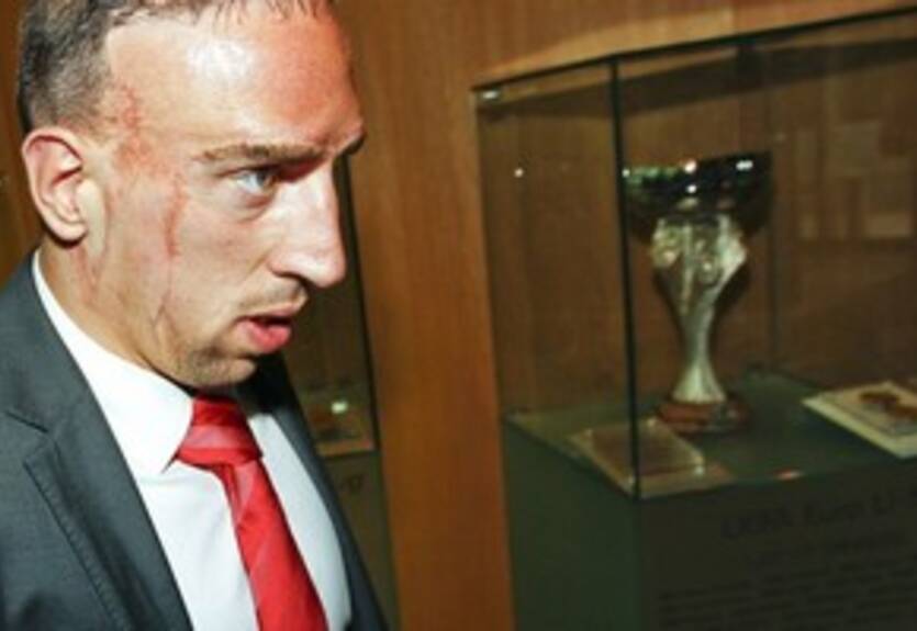 Хенесс: &quot;У нас не было поддержки в УЕФА&quot;