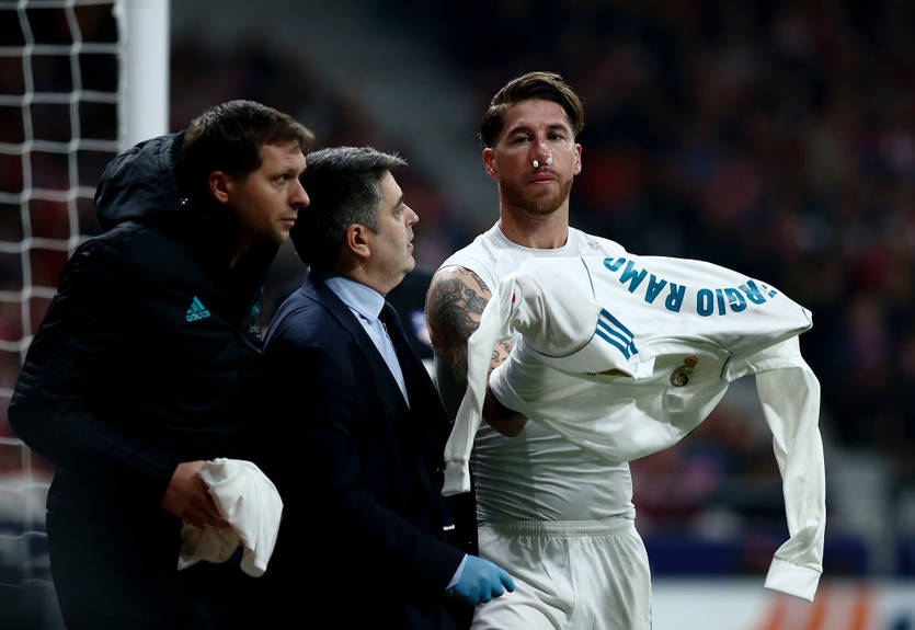 Рамос впервые показал свой сломанный нос