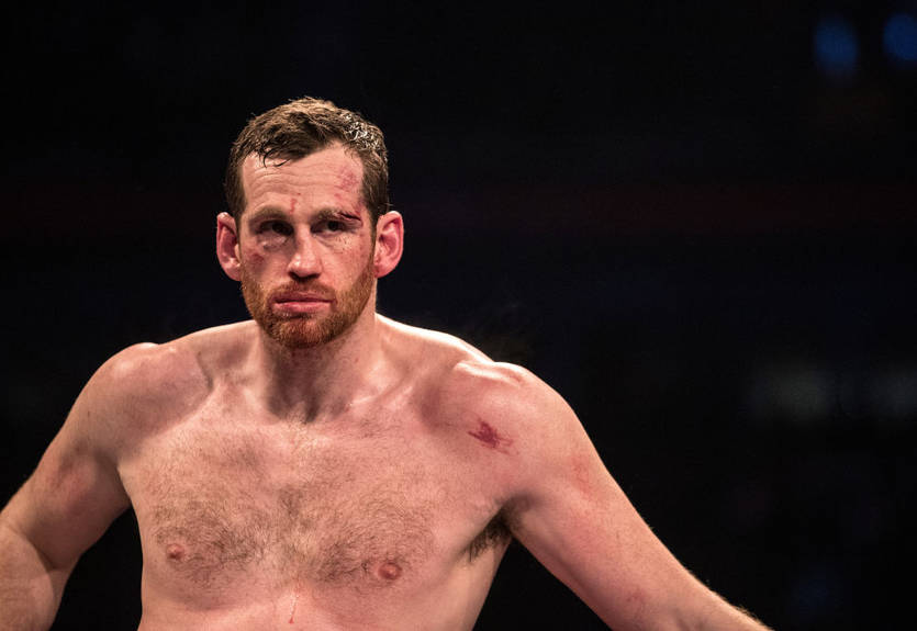 Прайсу после нокаута от Поветкина наложили 40 швов