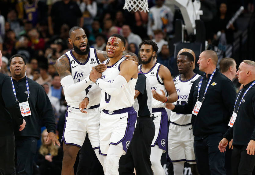 Вестбруку розбили голову, після чого він отримав технічний фол