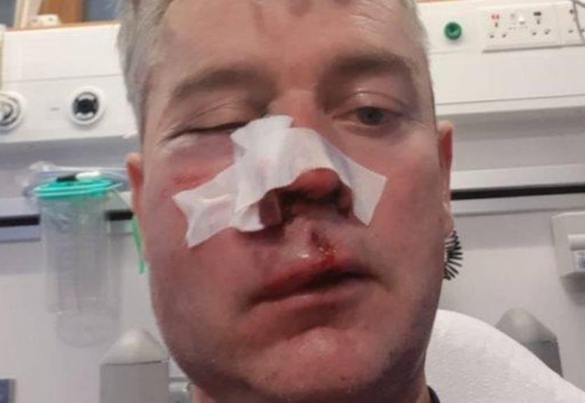 В Ирландии игроки сломали челюсть и нос судье после матча