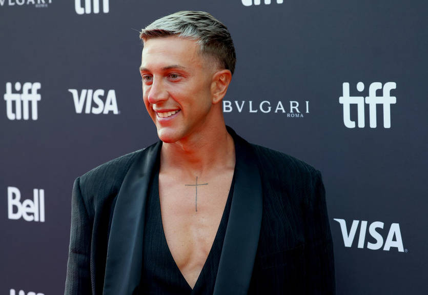 Шокирующая трансформация: Футболист сборной Италии сделал пластическую операцию