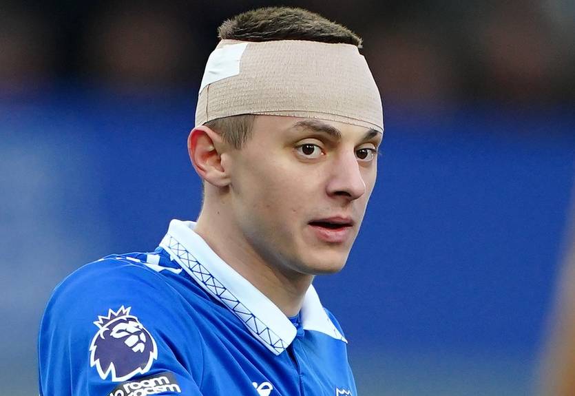 Миколенко разбили голову в матче Эвертона и Астон Виллы