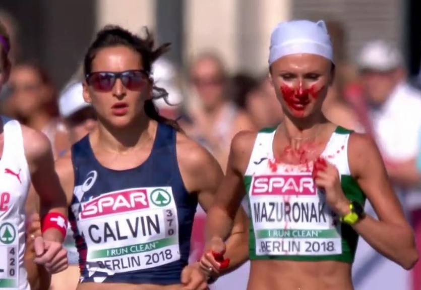 Что может спровоцировать кровь из носа после пробежки?