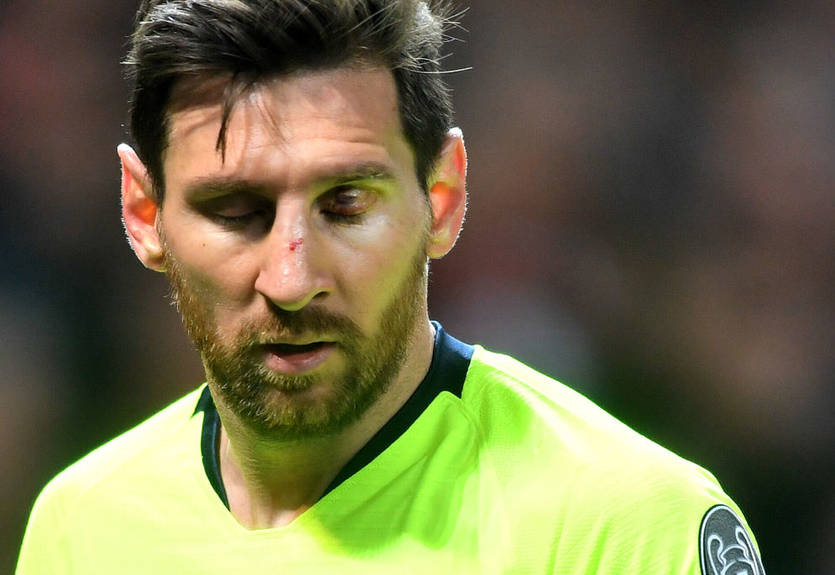 Смоллинг впервые рассказал об эпизоде, когда разбил нос Месси