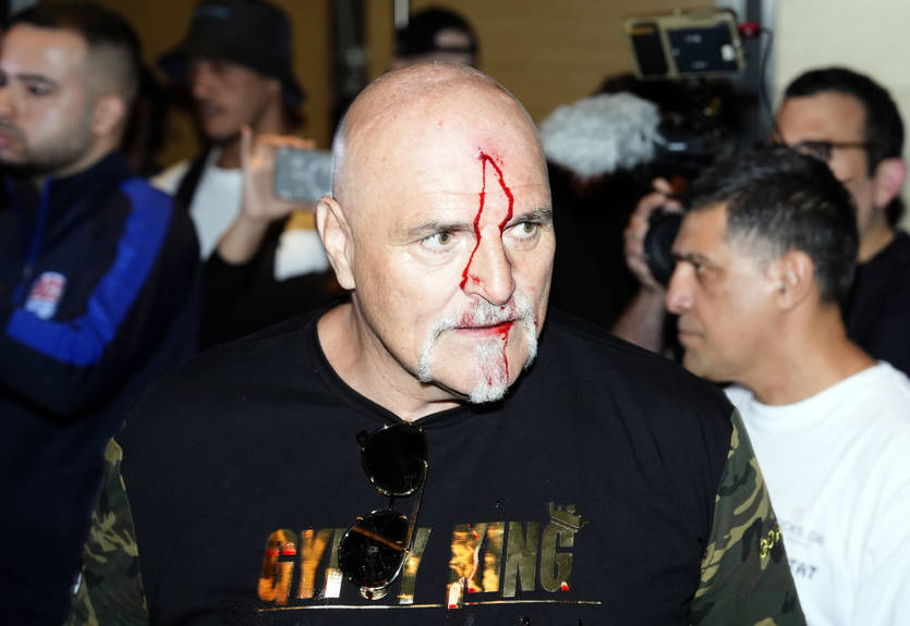 Кров по всьому обличчю: батько Ф'юрі вдарив представника команди Усика Кров по всьому обличчю: батько Ф'юрі вдарив представника команди Усика