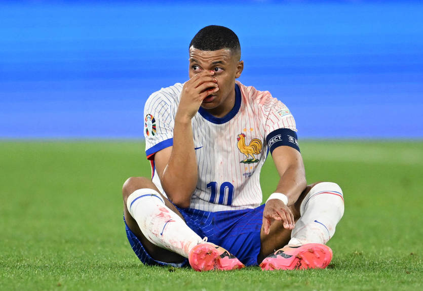 Мбаппе сломал нос в матче Евро-2024, после чего получил странную желтую карточку