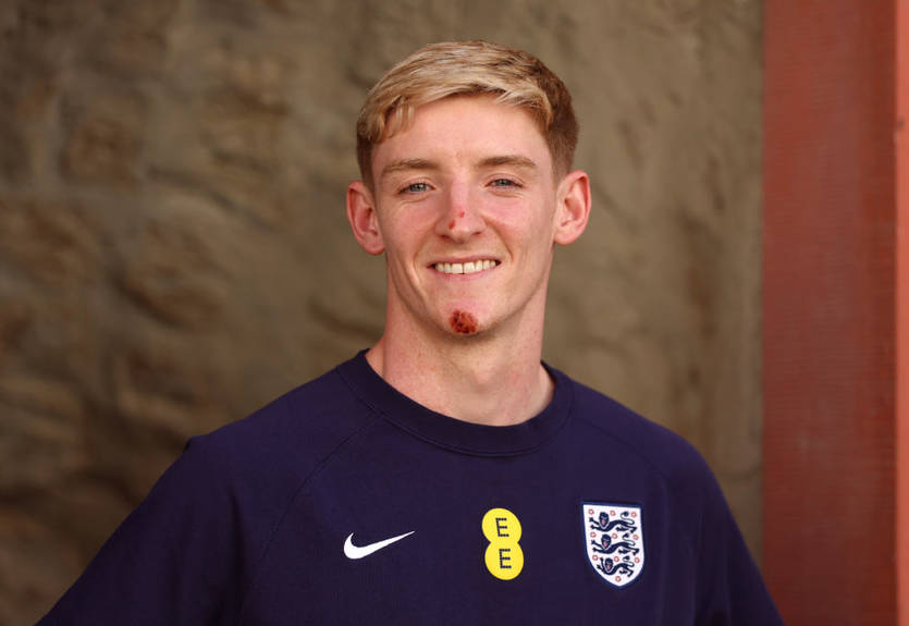 Футболіст збірної Англії отримав у подарунок дитячий шолом після падіння з велосипеда