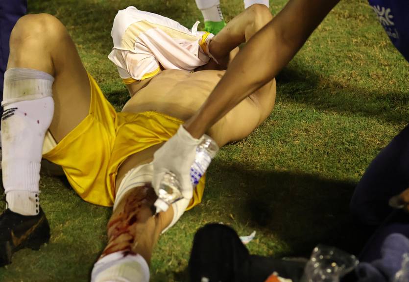 В Бразилии полицейский выстрелил в футболиста прямо во время матча