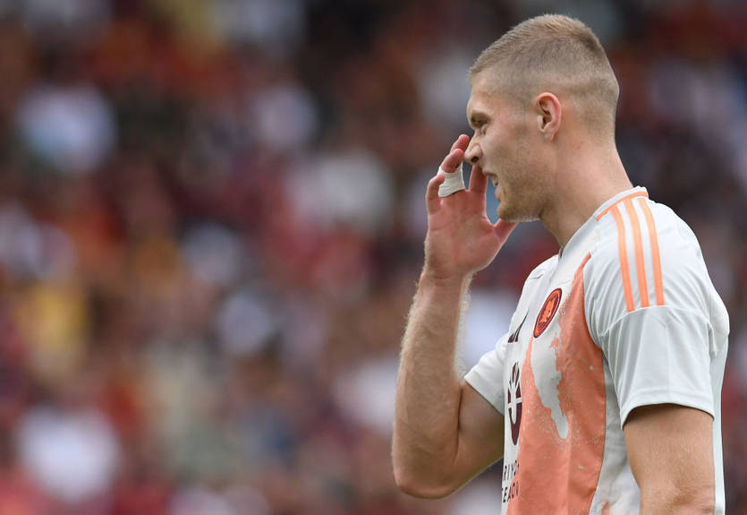 Довбик ризикує пропустити найближчий матч Роми